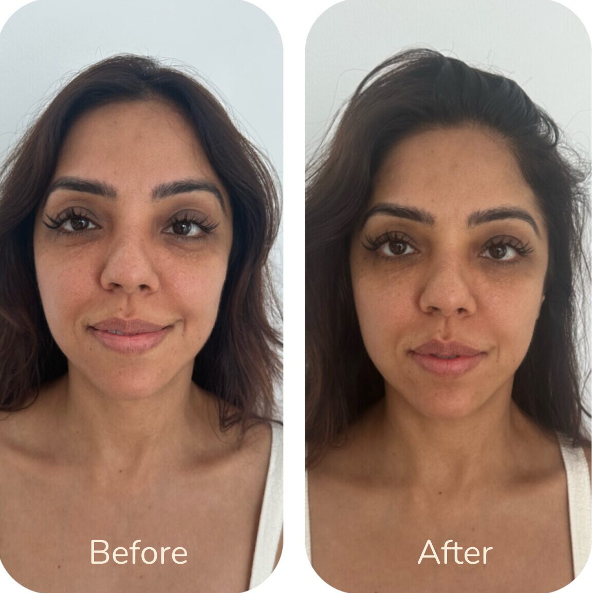 Before-16