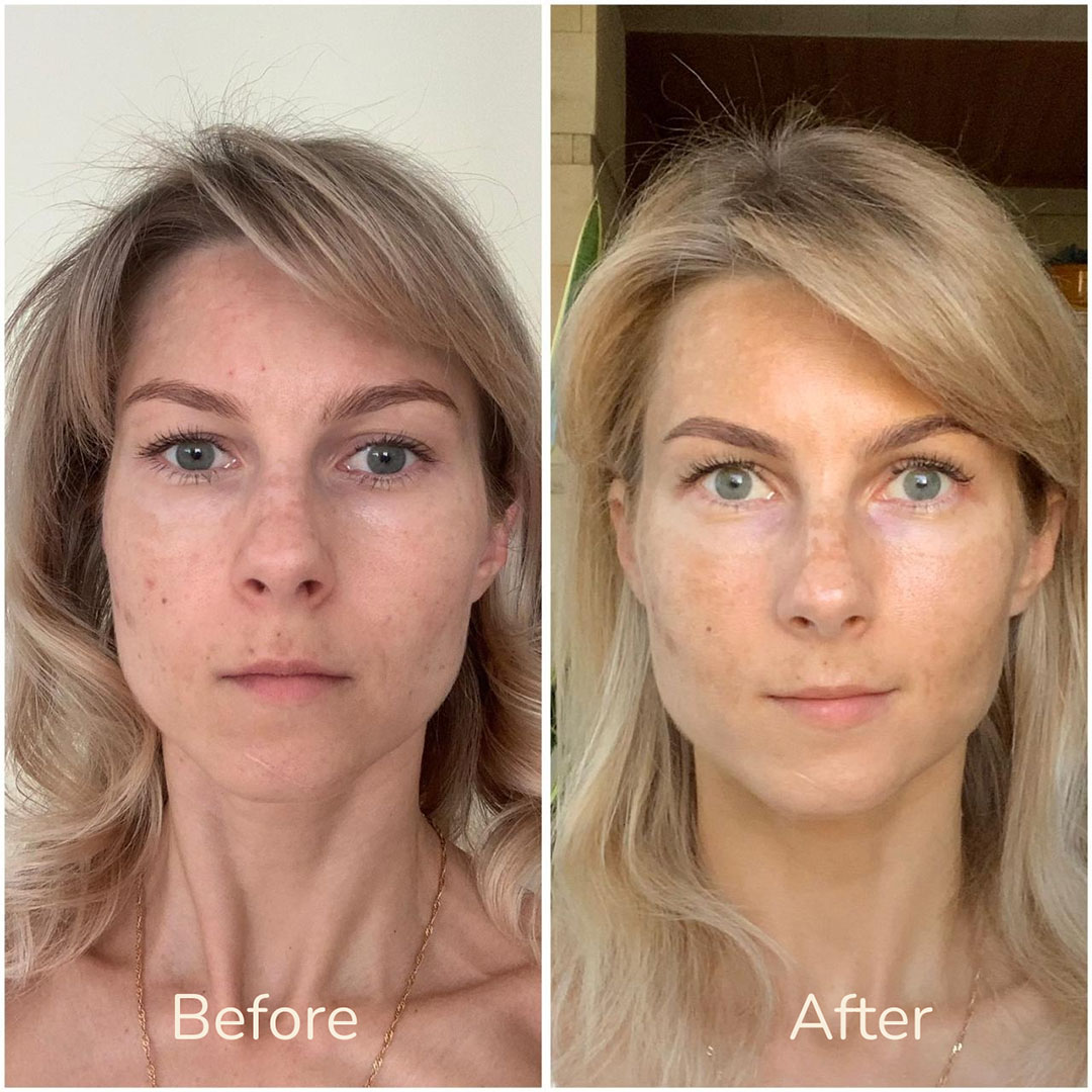 Before - 1